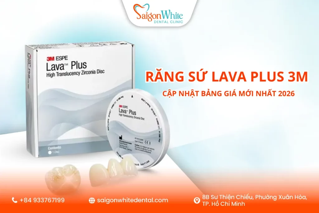 Răng sứ Lava Plus 3M là gì? Cập nhật bảng giá mới nhất 2026 