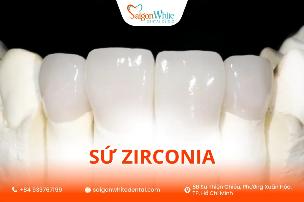 Sứ Zirconia thẩm mỹ cao
