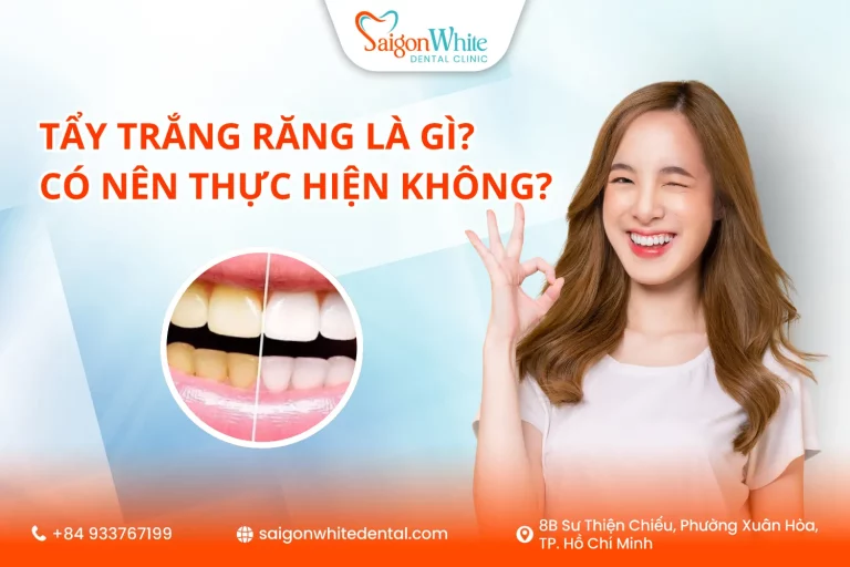 Tẩy trắng răng là gì? Có nên thực hiện không?