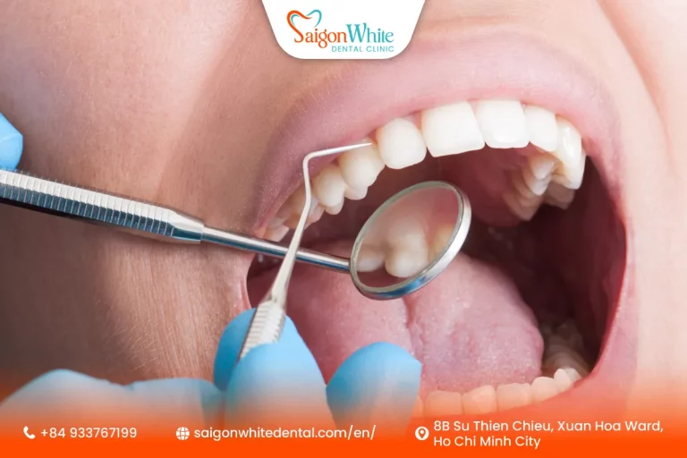 Teeth Cleaning Cost