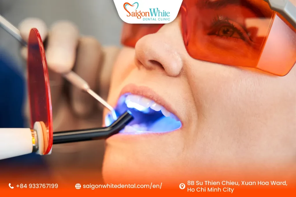 How Much Is the Cost of a Tooth Filling in Ho Chi Minh City, Vietnam?