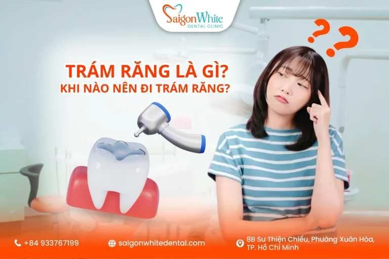 Trám răng là gì? Khi nào nên đi trám răng?