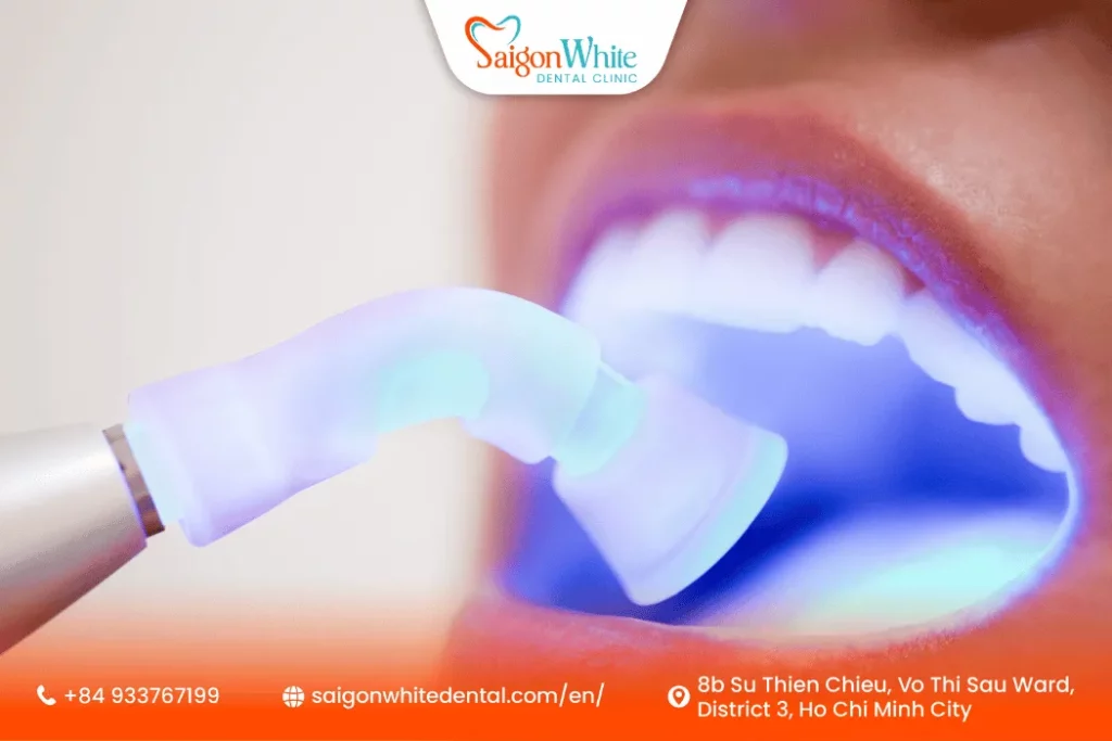 Unveiling the Benefits of Professional Dental Fillings