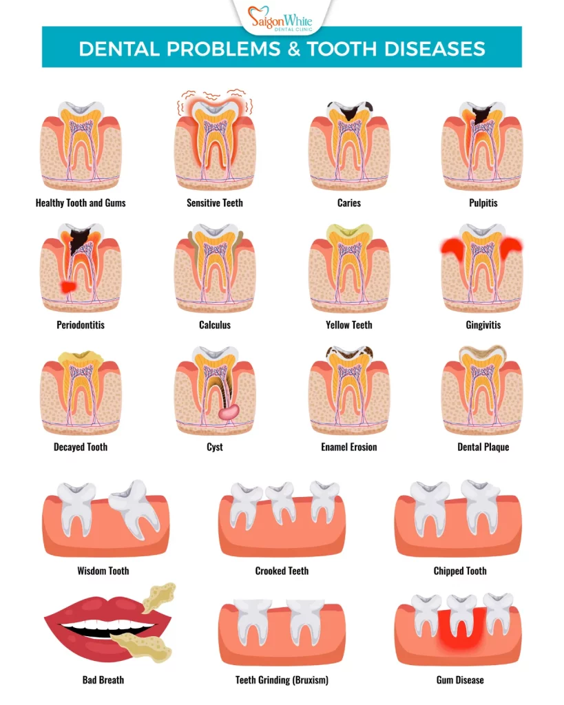 Some signs of dental disease