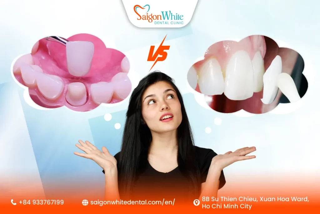 What is the difference between a dental crown and a veneer?