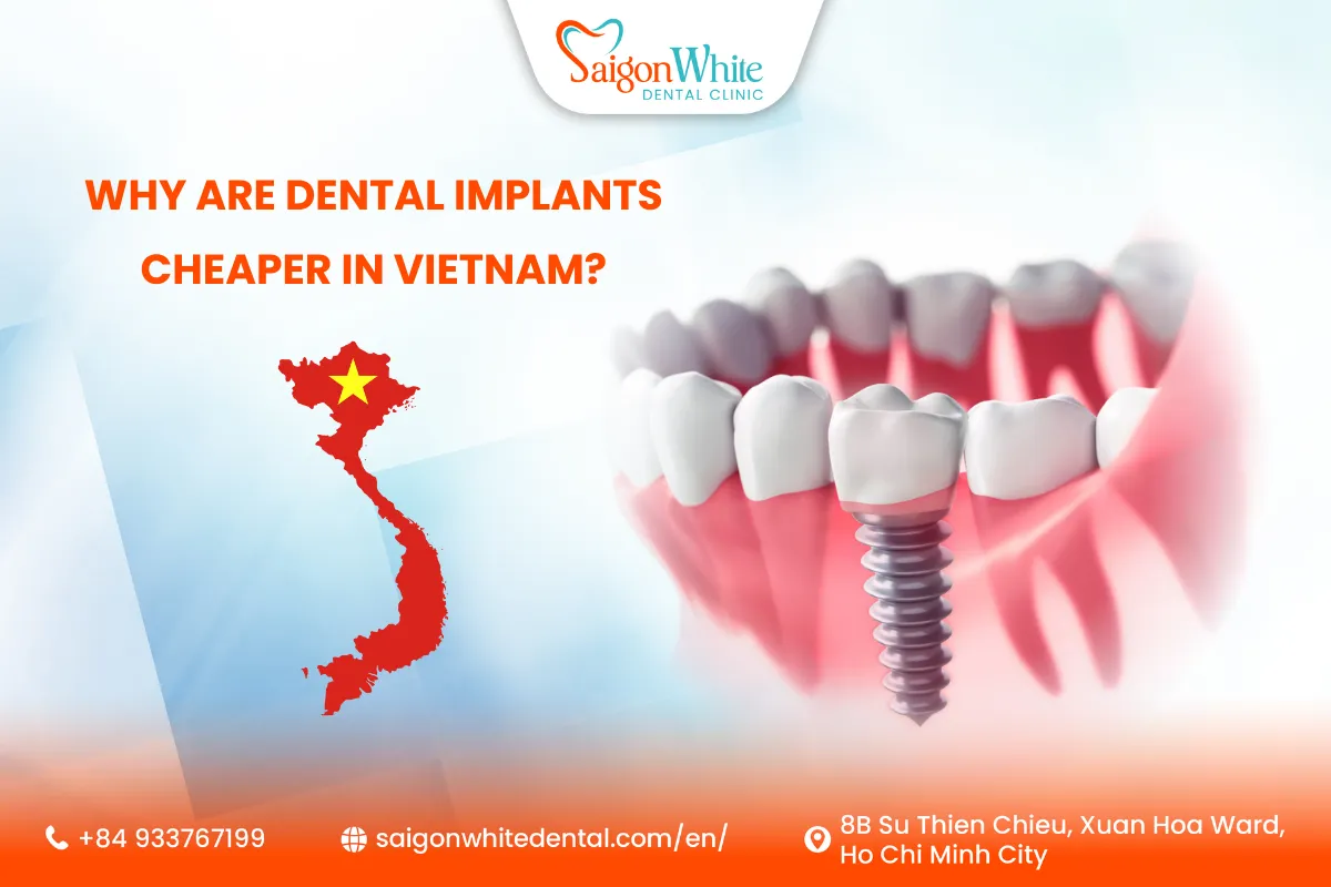 Why Are Dental Implants Cheaper in Vietnam? - Saigon White Dental Clinic
