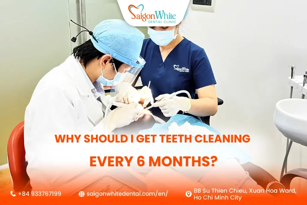 Why Should I Get Teeth Cleaning Every 6 Months?