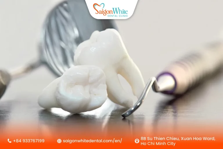 Wisdom Teeth Extraction Cost