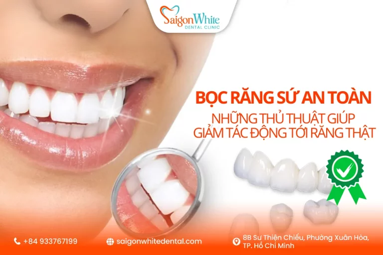 Bọc răng sứ an toàn: Những thủ thuật giúp giảm tác động tới răng thật