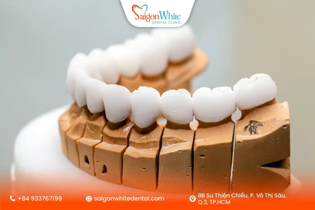 Những lưu ý quan trọng sau khi bọc răng sứ