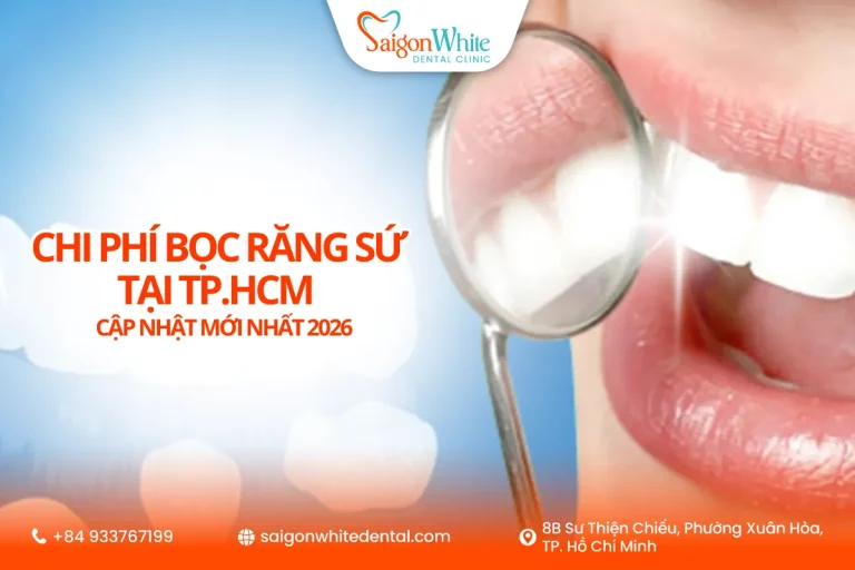 Chi phí bọc răng sứ tại Tp.HCM cập nhật mới nhất 2026