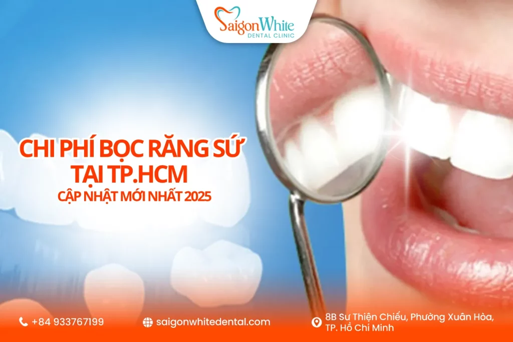 Chi phí bọc răng sứ tại Tp.HCM cập nhật mới nhất 2025