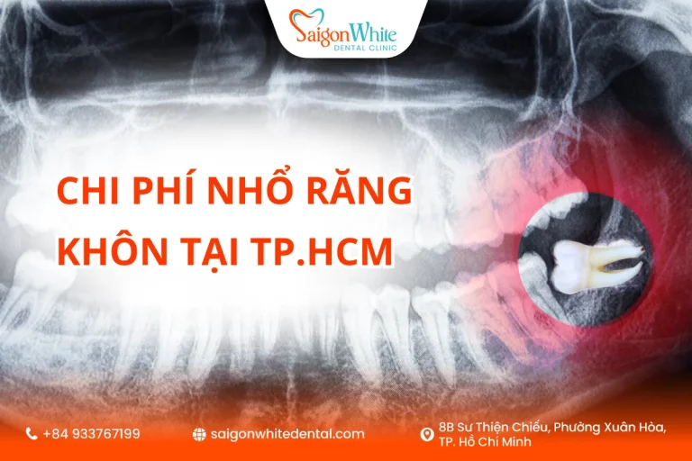 Chi phí nhổ răng khôn tại TP.HCM