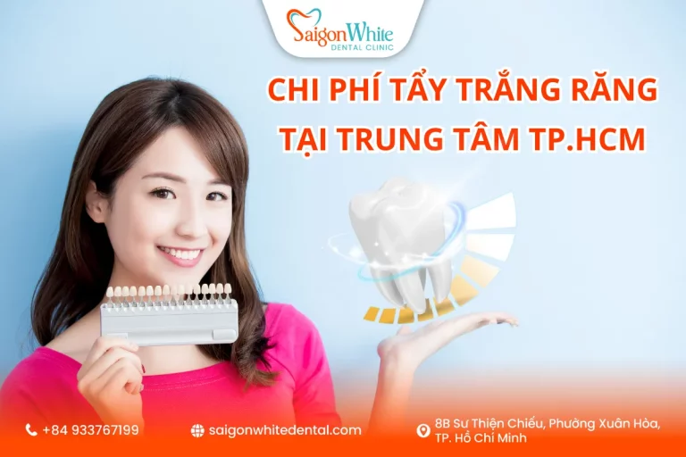 Chi phí tẩy trắng răng tại trung tâm TP.HCM