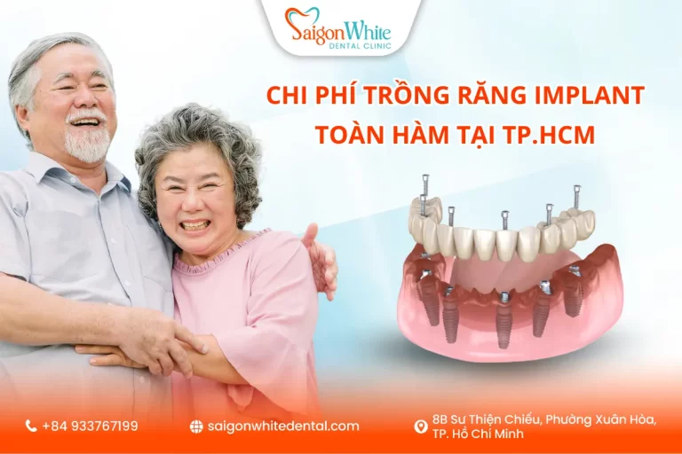 Chi phí trồng răng implant toàn hàm tại TP.HCM