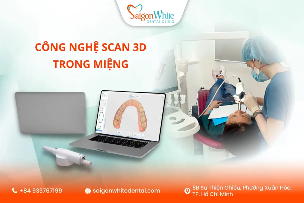 Công nghệ Scan 3D trong miệng 