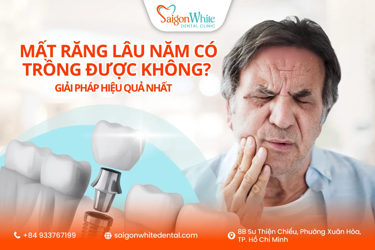 Mất răng lâu năm có trồng được không? Giải pháp hiệu quả nhất
