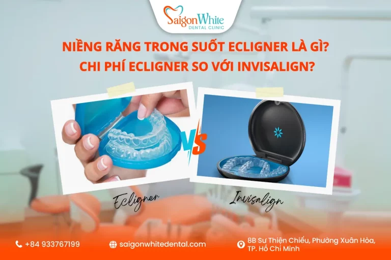 ecligner là gì, chi phí niềng ecligner so với invisalign