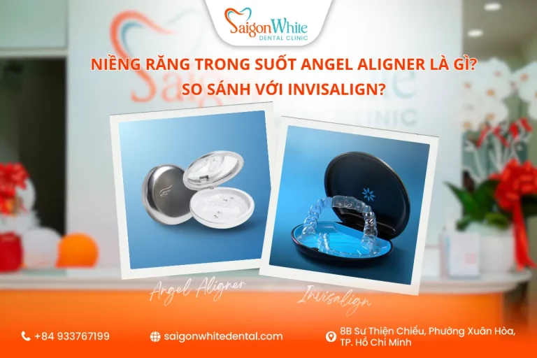 Niềng răng trong suốt Angel Aligner và niềng răng trong suốt Invisalign