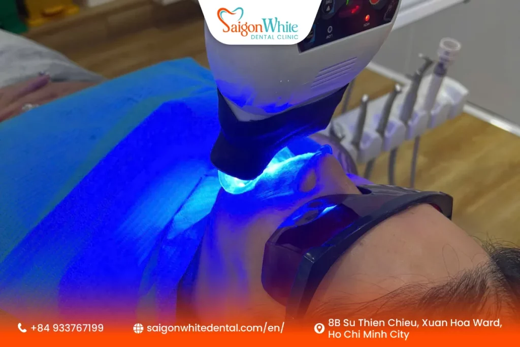 An international patient had her teeth whitened at Saigon White Dental Clinic