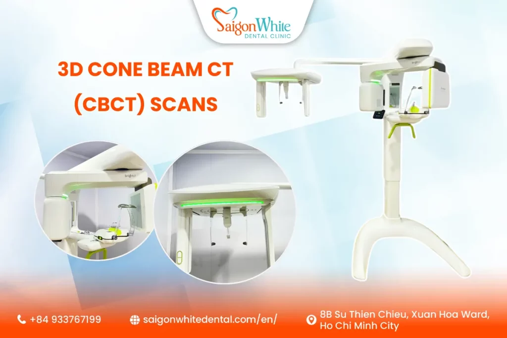 3D Cone Beam CT (CBCT) Scans in Ho Chi Minh City