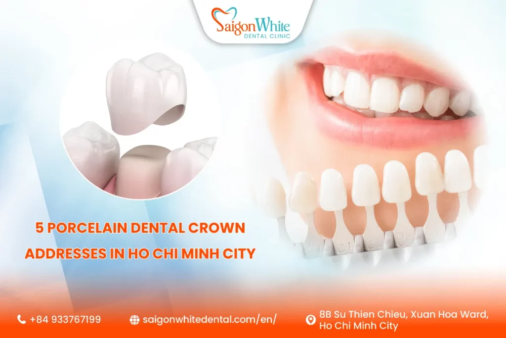 5 Porcelain Dental Crown Addresses in Ho Chi Minh City