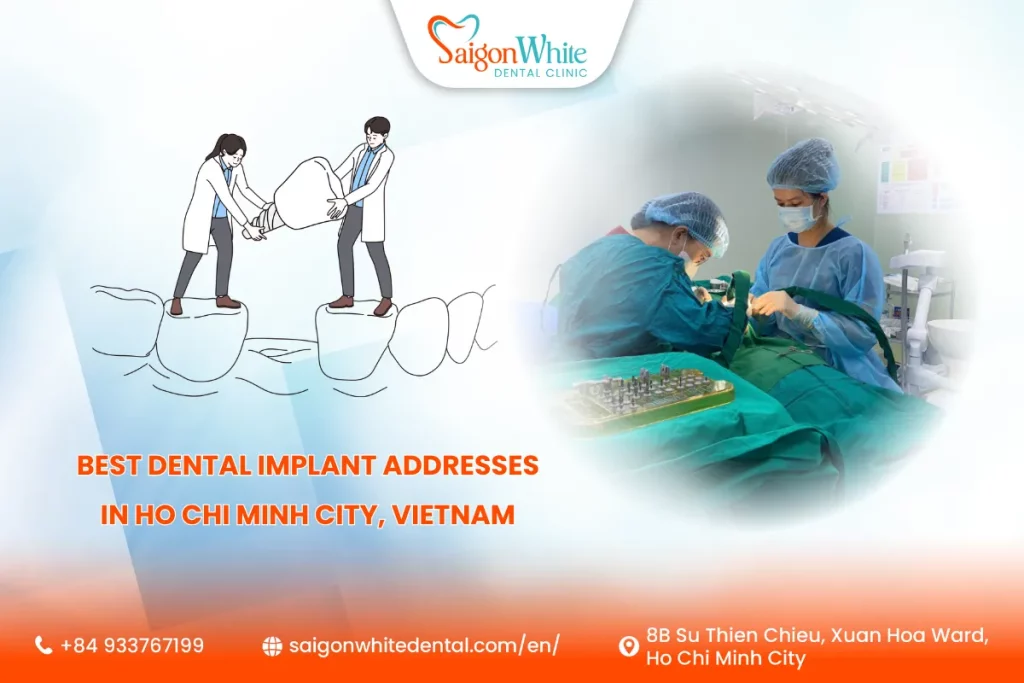 5 Best Dental Implant Addresses in Ho Chi Minh City, Vietnam