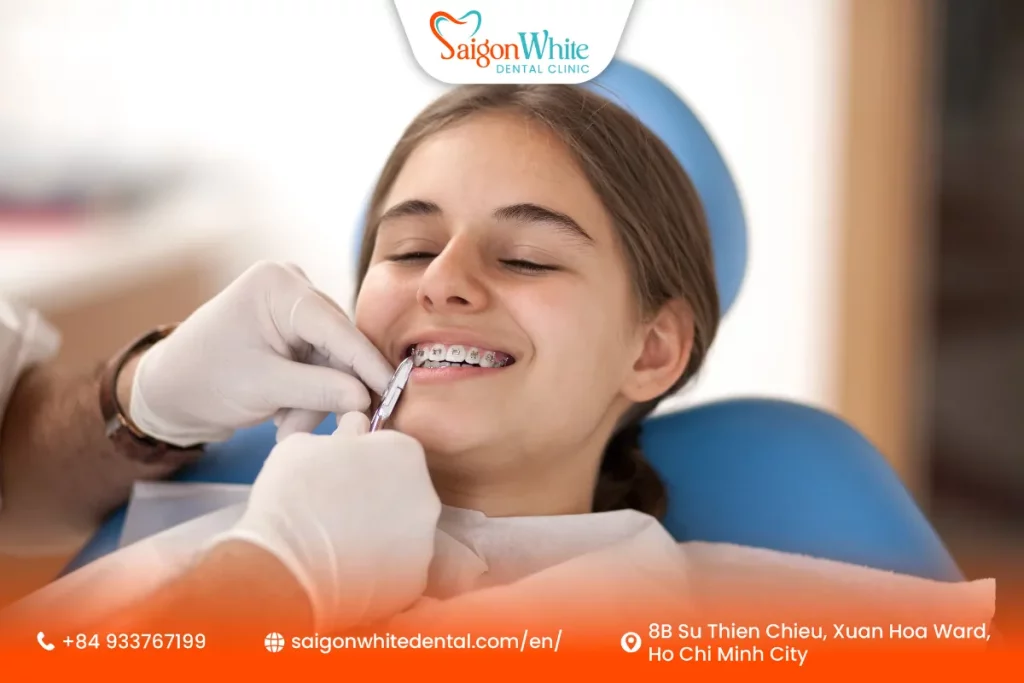 Braces Procedure Step-by-Step