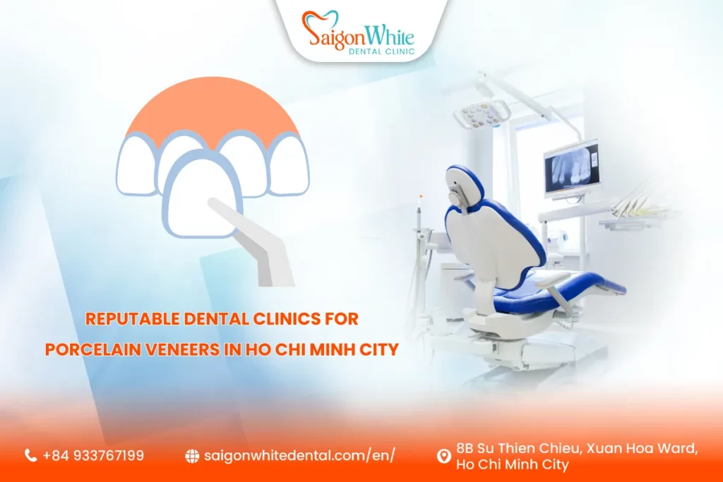 Top 5 Reputable Dental Clinics for Porcelain Veneers in Ho Chi Minh City