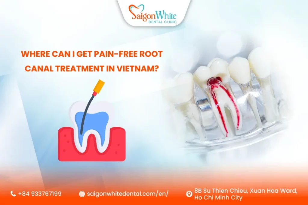 Where can I get pain-free root canal treatment in Vietnam