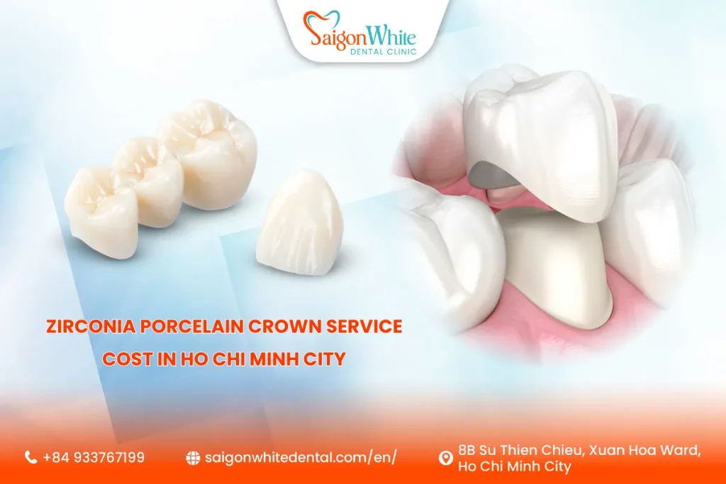 How Much Does Zirconia Porcelain Crown Service Cost In Ho Chi Minh City
