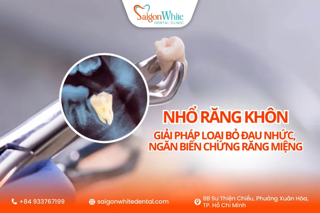 Răng khôn là giải pháp loại bỏ đau nhức, ngăn biến chứng răng miệng
