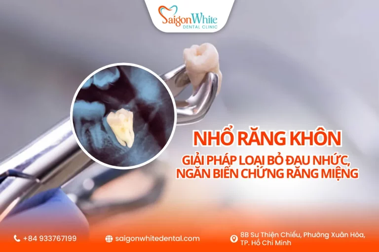 Răng khôn là giải pháp loại bỏ đau nhức, ngăn biến chứng răng miệng