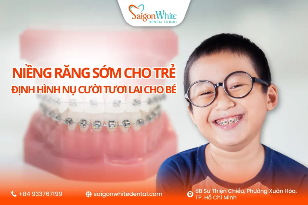 Niềng răng sớm cho trẻ: Định hình nụ cười tươi lai cho bé