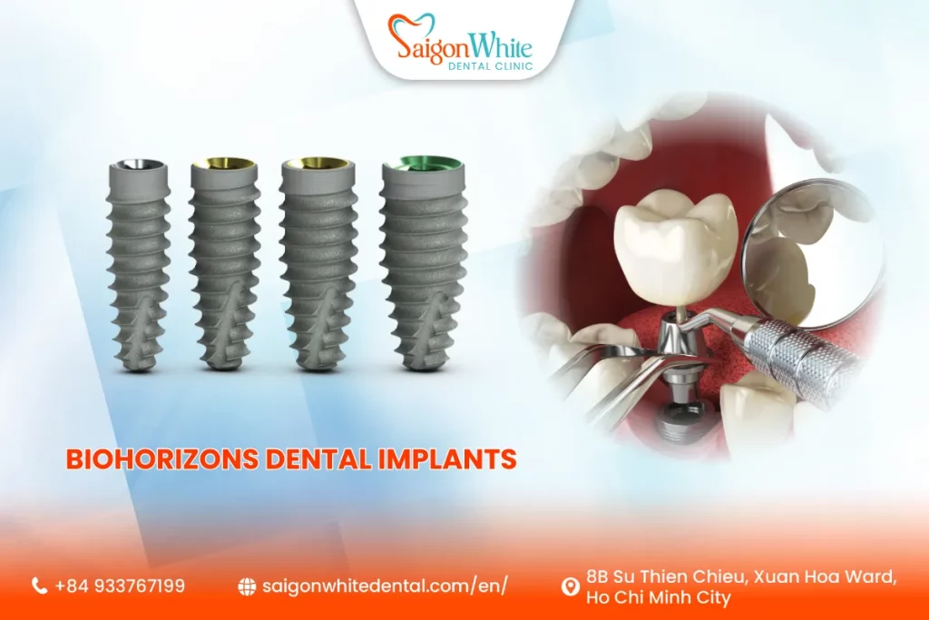 BioHorizons Dental Implants in Vietnam