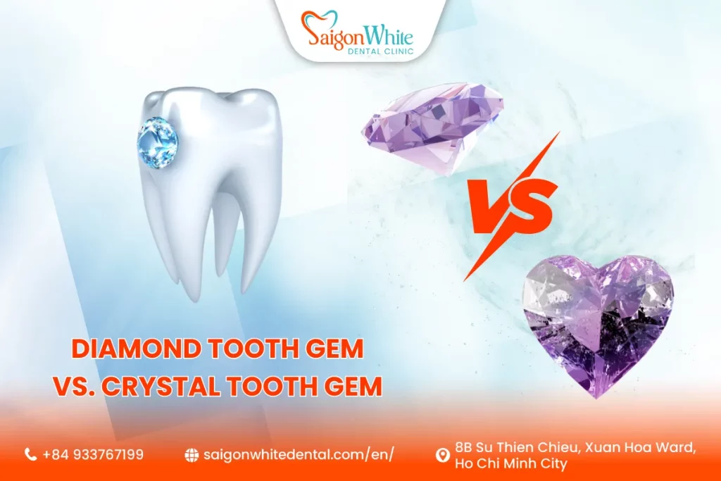 Diamond Tooth Gem vs. Crystal Tooth Gem
