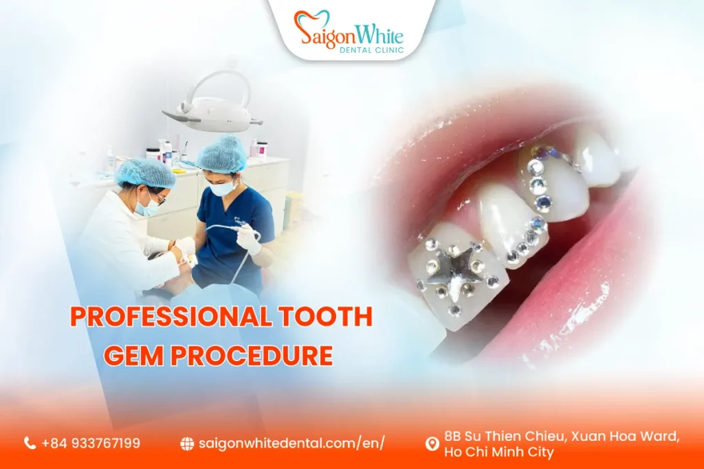 Professional Tooth Gem Procedure vs. DIY Tooth Gem Kits