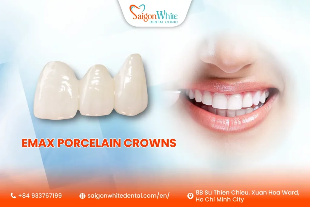 Emax Porcelain Crowns in Ho Chi Minh