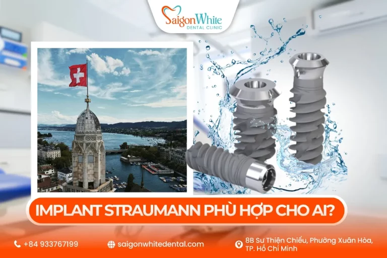 Implant Straumann phù hợp cho ai? Xuất xứ và chi phí