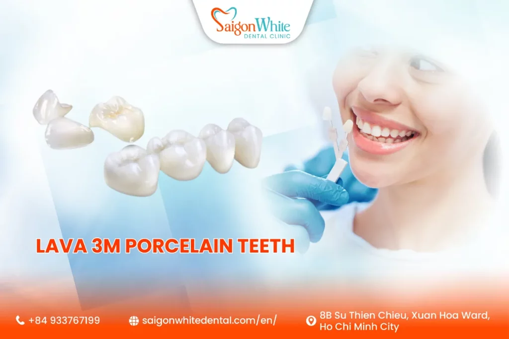Lava 3M Porcelain Teeth Cost In Vietnam