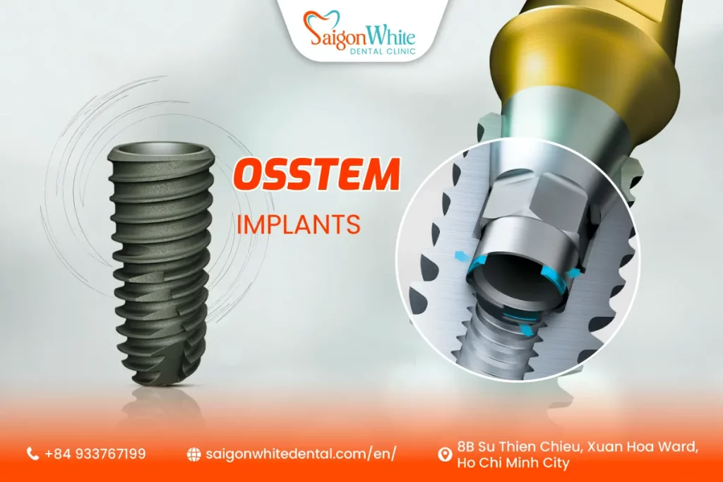Why Osstem Implants Are Popular Among Expats