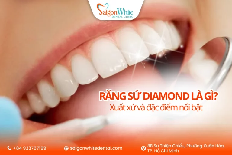 Răng sứ Diamond là gì? Đặc điểm và xuất xứ