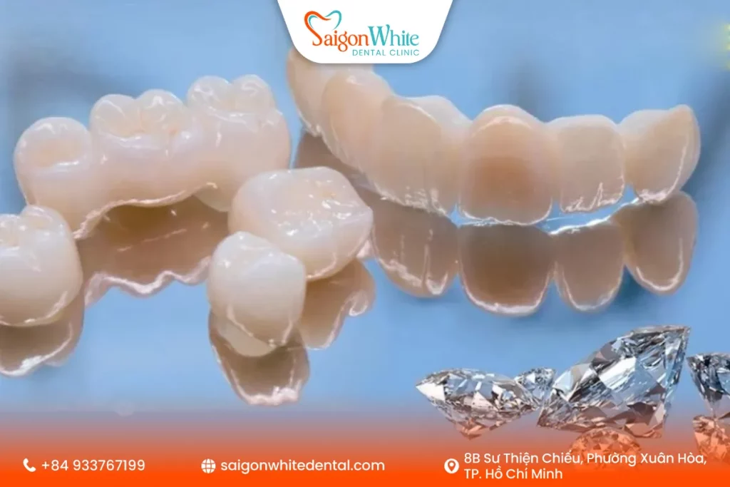 Răng sứ Diamond