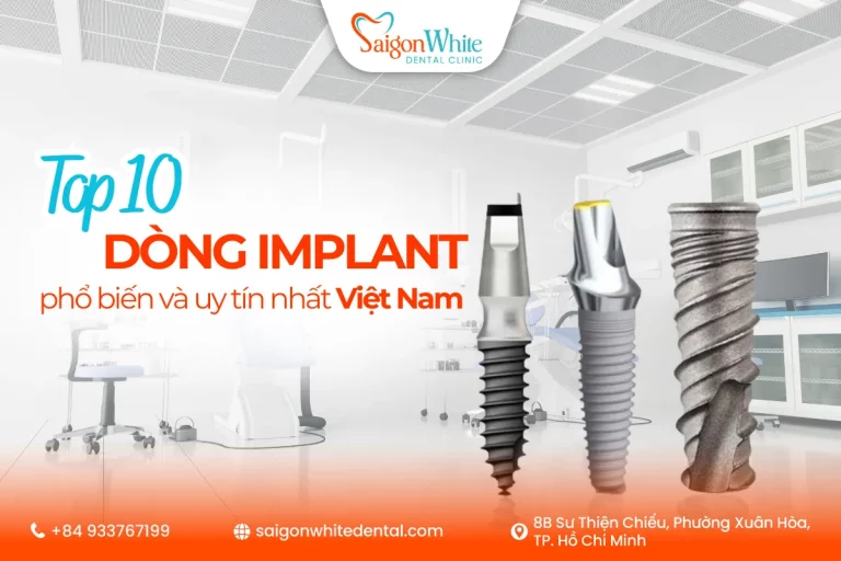 Top 10 dòng Implant phổ biến và uy tín nhất Việt Nam