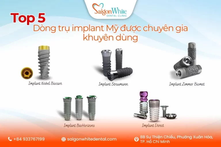 Top 5 dòng trụ implant Mỹ được chuyên gia khuyên dùng
