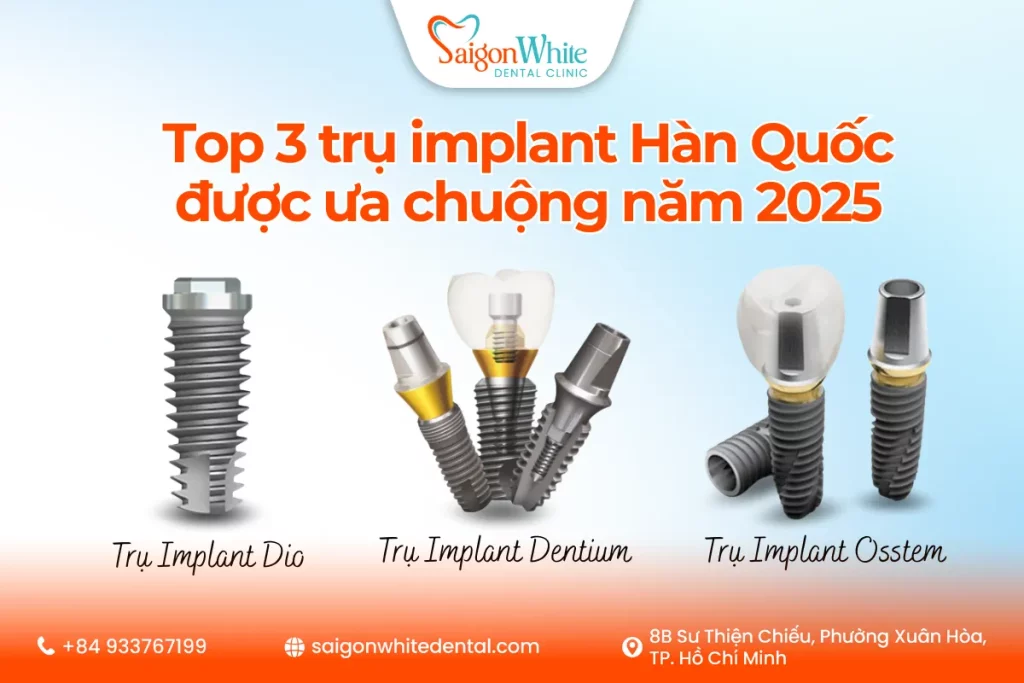 Top 3 trụ implant Hàn Quốc được ưa chuộng năm 2025
