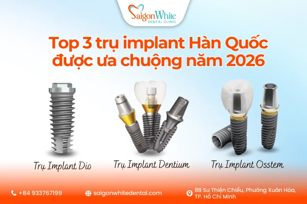 Top 3 trụ implant Hàn Quốc được ưa chuộng năm 2026