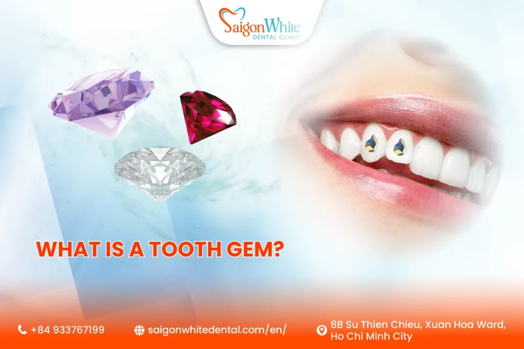 What Is a Tooth Gem?