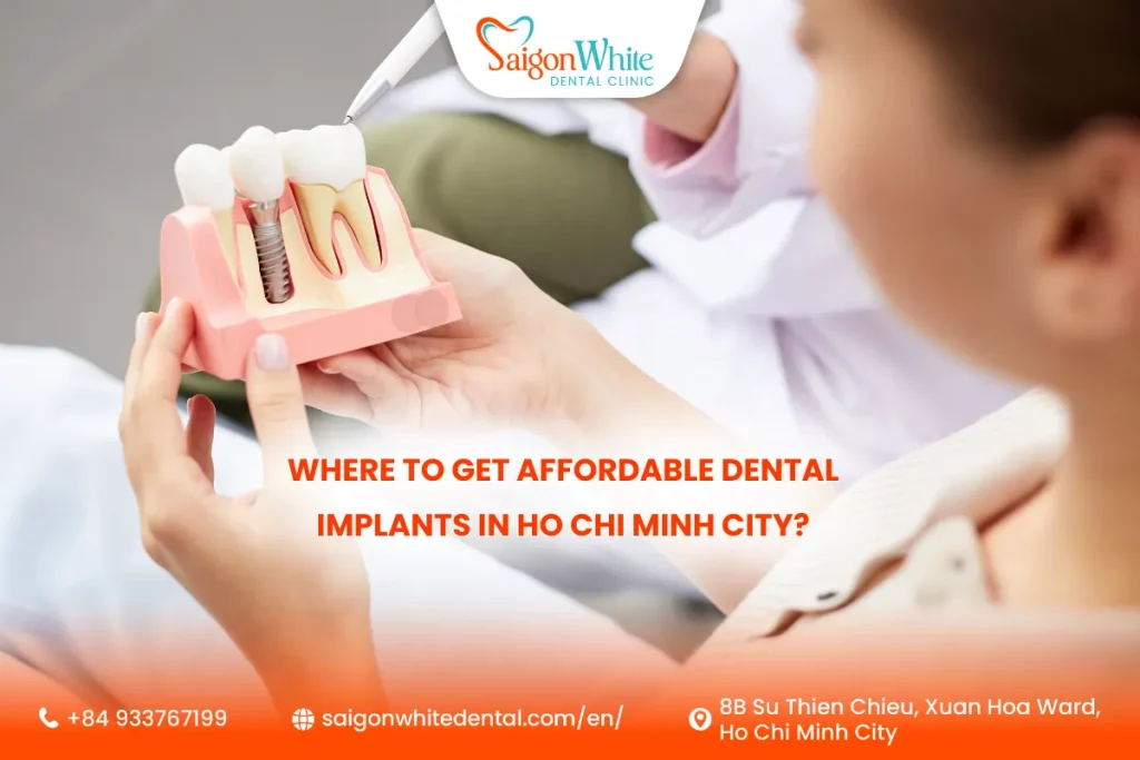 Where to get affordable dental implants in Ho Chi Minh City?