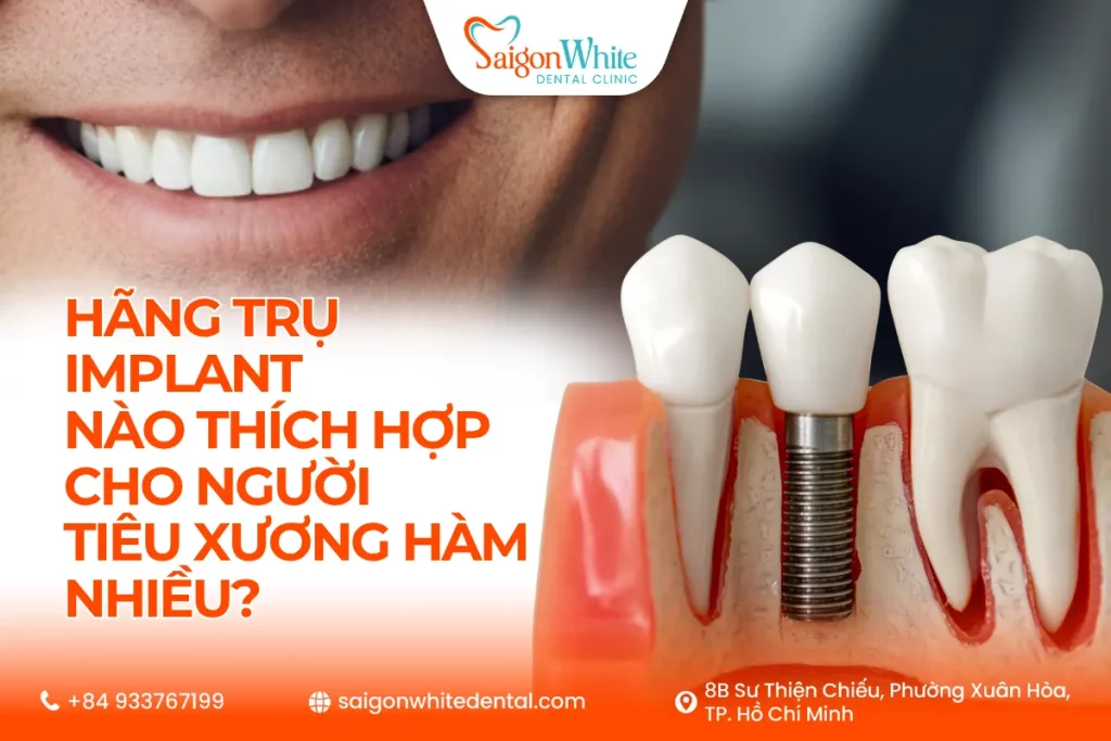 Hãng trụ implant nào cho người tiêu xương hàm nhiều